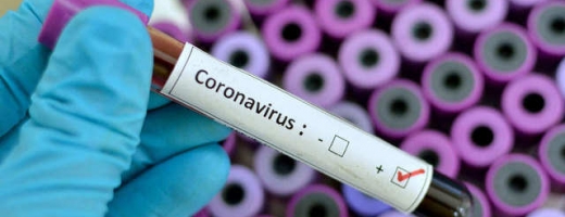 vedetele-nu-scapa-nici-ele-de-coronavirus-patru-nume-importante-au-contactat-virusul