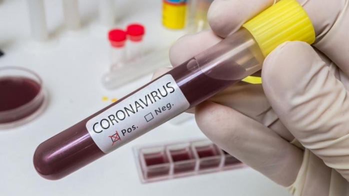 10 cazuri noi de CORONAVIRUS în județul Cluj în ultimele 24 de ore