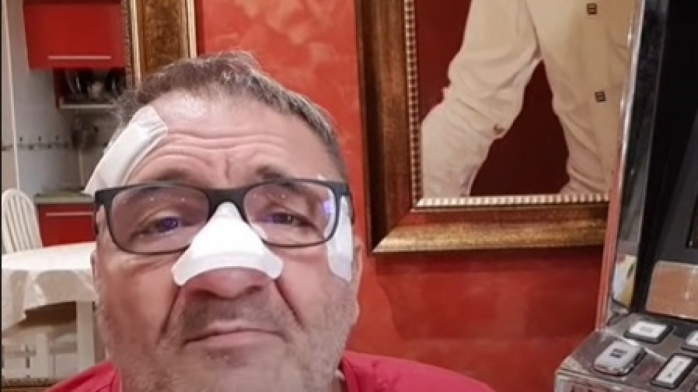 VIDEO. Nelson Mondialu a recunoscut că nu a fost bătut. Vloggerul a explicat cum a plănuit totul