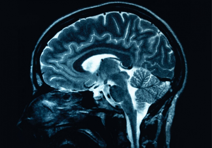 Descoperire inedită a unui cercetător român despre moartea cerebrală