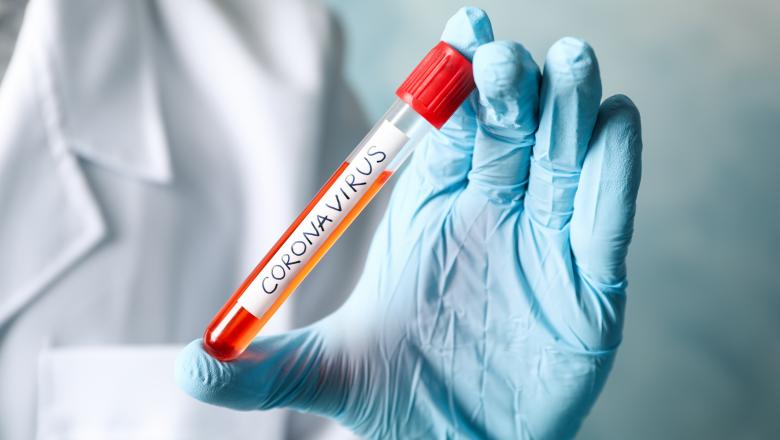 codasi-la-testari-romania-nu-a-facut-nici-macar-100000-de-teste-de-la-izbucnirea-pandemiei-de-coronavirus