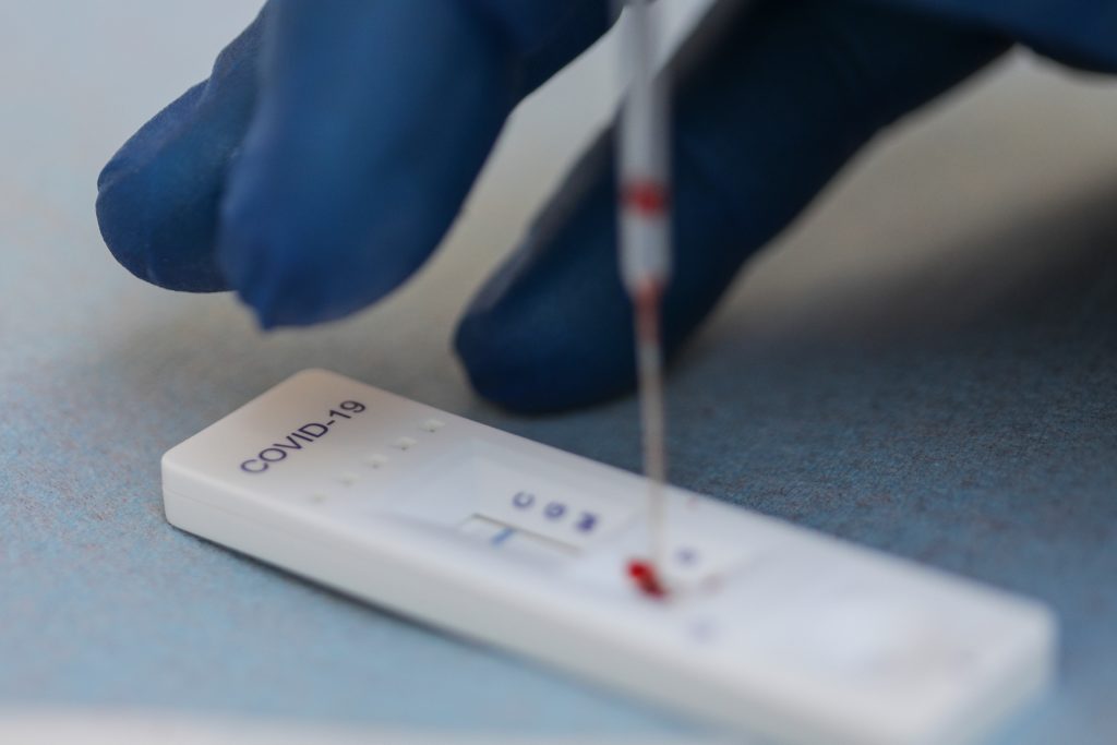 Noi teste de coronavirus pentru români! Cât costă şi unde se găsesc