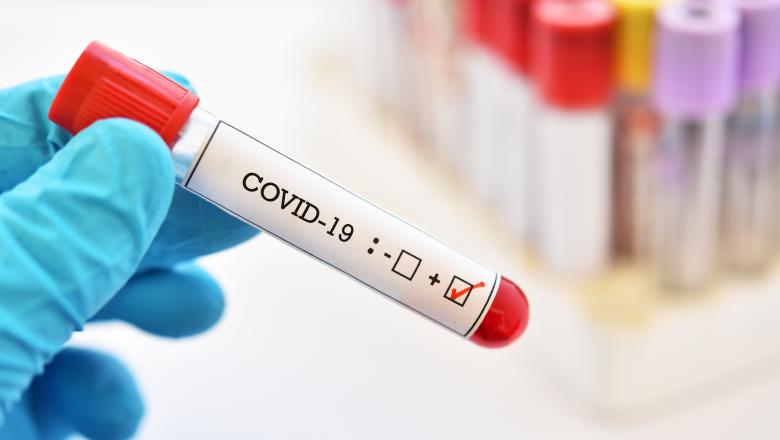 1.225 de cazuri noi de coronavirus în ultimele 24 de ore. O nouă zi cu peste 35 de decese