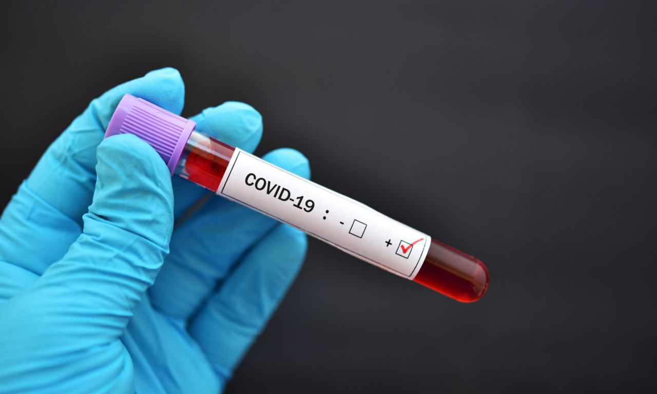 Fiecare român infectat cu Covid-19 transmite virusul către alte 40 de persoane