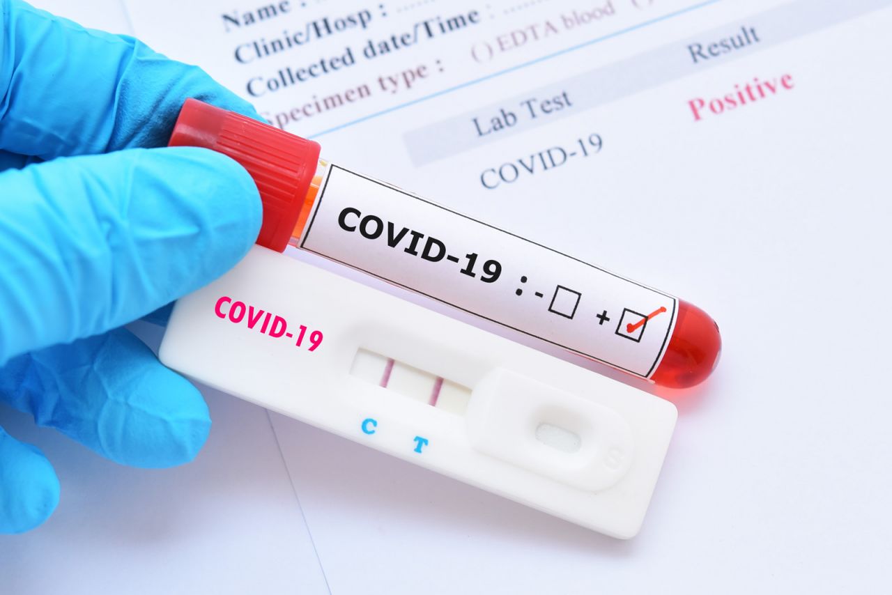 RECORD de cazuri de COVID-19 în ultimele 24 de ore la nivel național