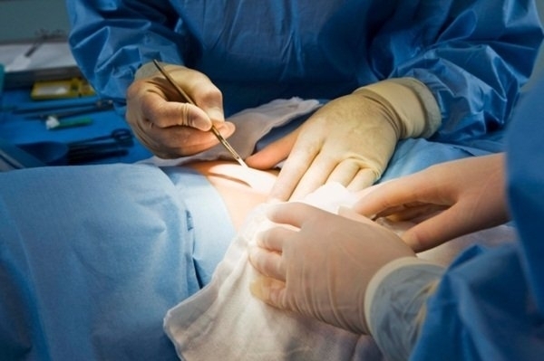 Medici din Arad și Cluj au prelevat organele unei femei aflate în moarte cerebrală