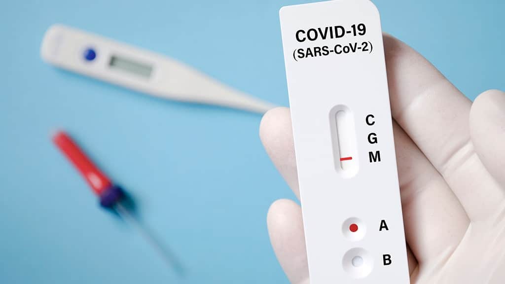 Medicii de familie vor putea face teste COVID-19 antigen și vor încasa câte 50 de lei pentru fiecare persoană testată