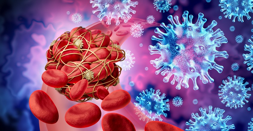 Studiu: COVID-19 crește riscul de cheaguri sangvine în primele 6 luni după infectare/ Sursă foto: depositphotos.com