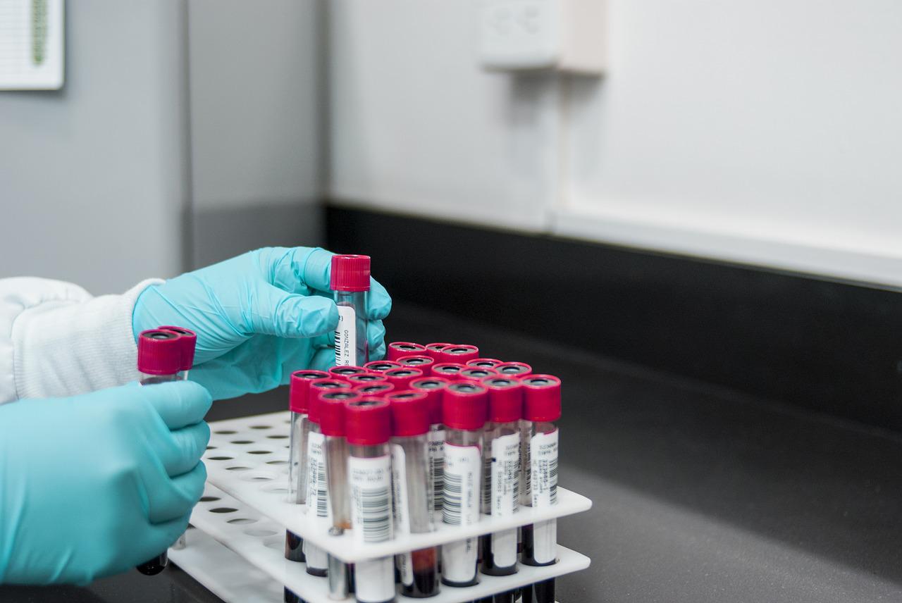 Testul de sânge care revoluționează lupta cu cancerul. FOTO: Pixabay