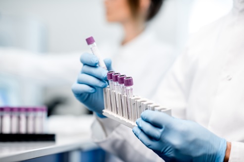 Testele de laborator examinează o mostră de sânge, urină sau țesuturi corporale