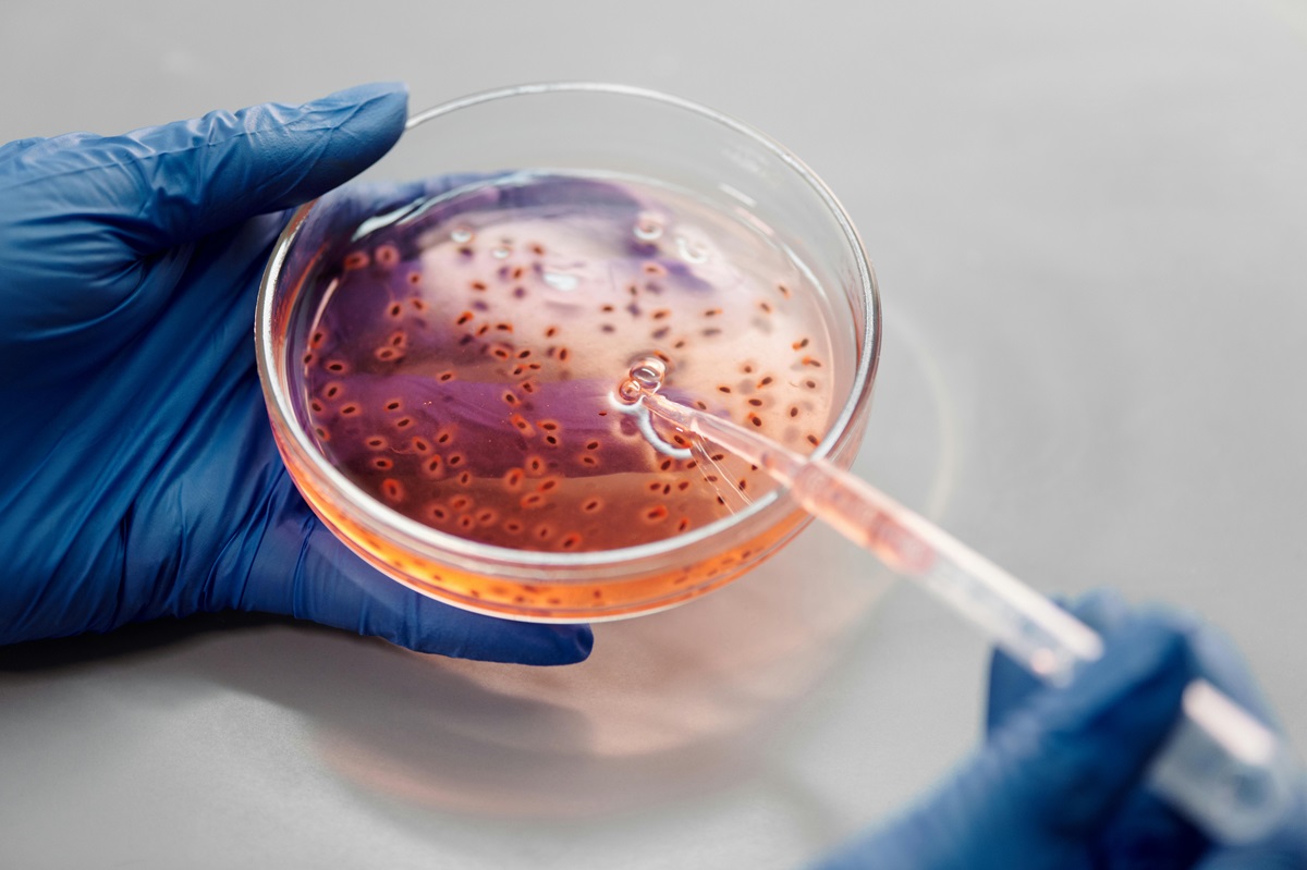 Bacterii într-un laborator. Sunt create puține antibiotice noi, deși proliferă superbacteriile. Foto: pexels.com