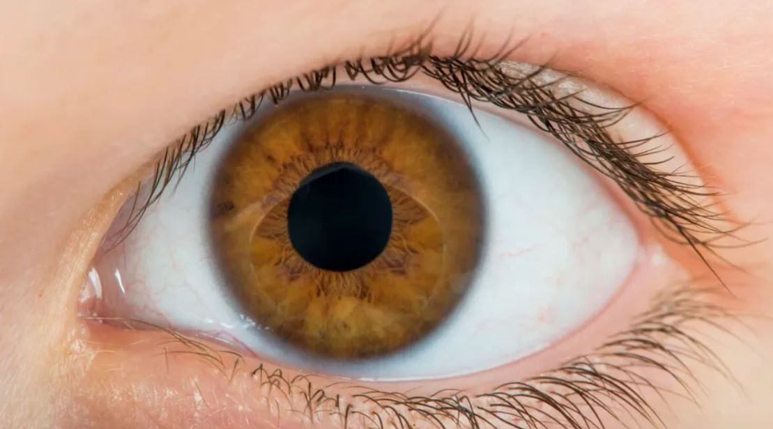 Semne demență la 45 de ani. Cum arată ochii când ai risc crescut de Alzheimer.