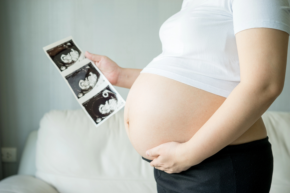 Programul Programul de Fertilizare in Vitro (FIV) va fi reluat | Foto: depositphotos.com / Fotografie ilustrativă